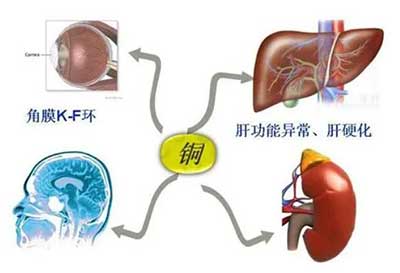 人体微量元素检测仪数据能够准检测出但身体中微量元素铜超标会引起疾病发生